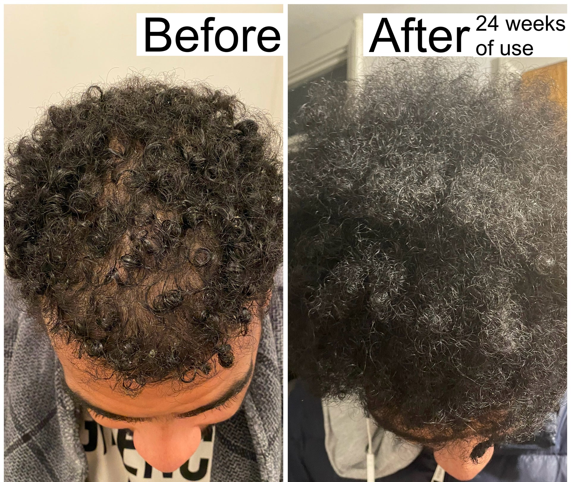 Advanced Hair Growth Oil | 002