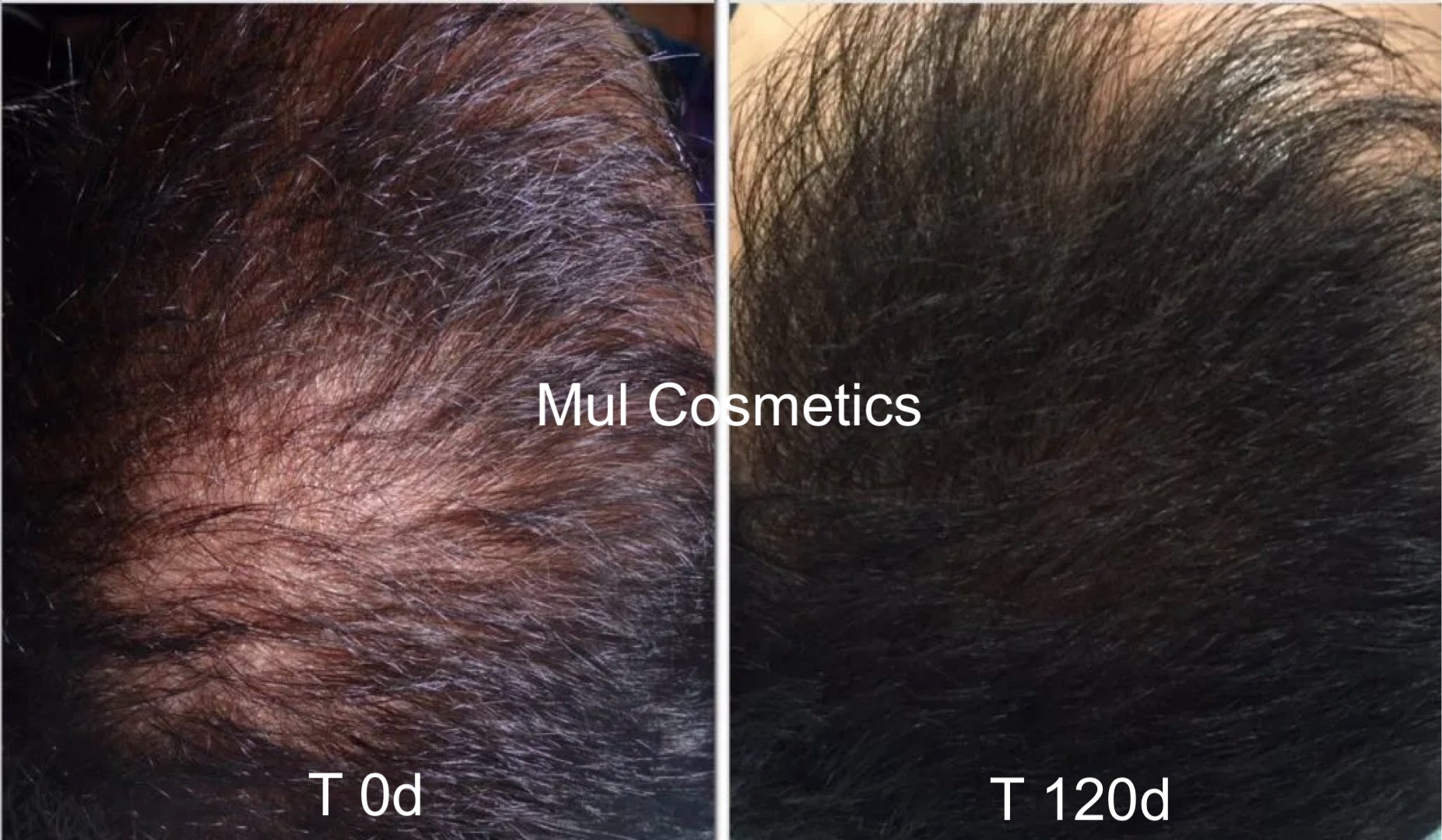 Advanced Hair Growth Oil | 002