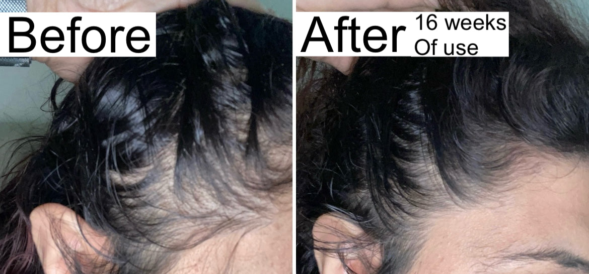 Advanced Hair Growth Oil | 002