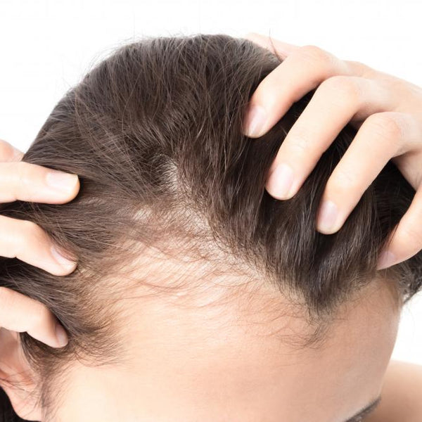 Hair Loss in Women: Triggers and Treatments
