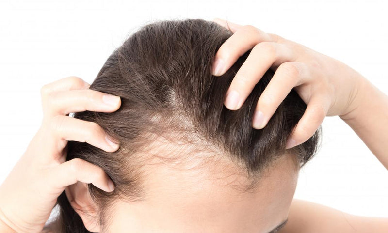 Hair Loss in Women: Triggers and Treatments